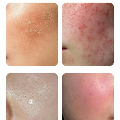 🔥Elektromos arctisztító fűtéssel és rezgéssel